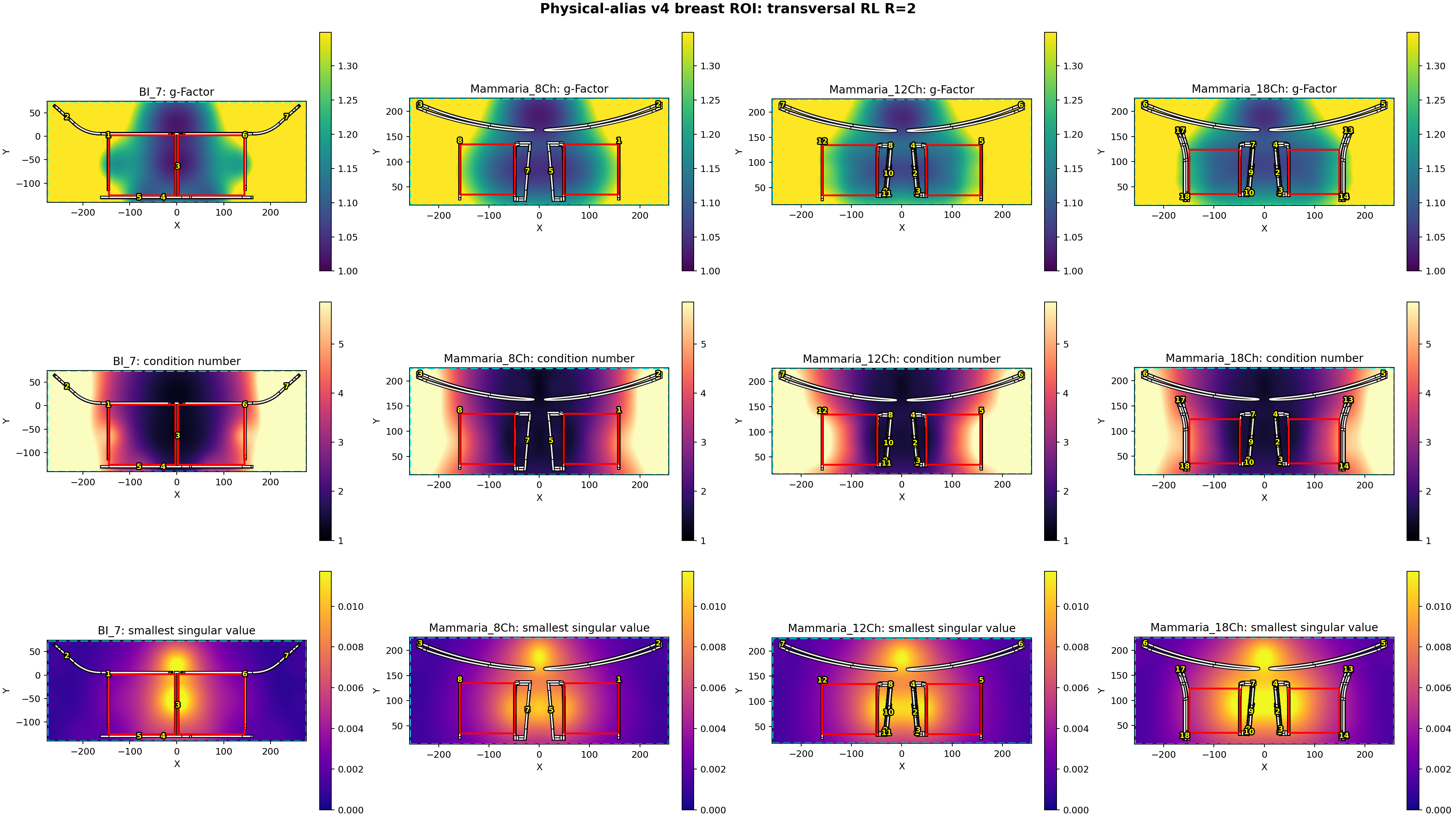 transversal RL R=2