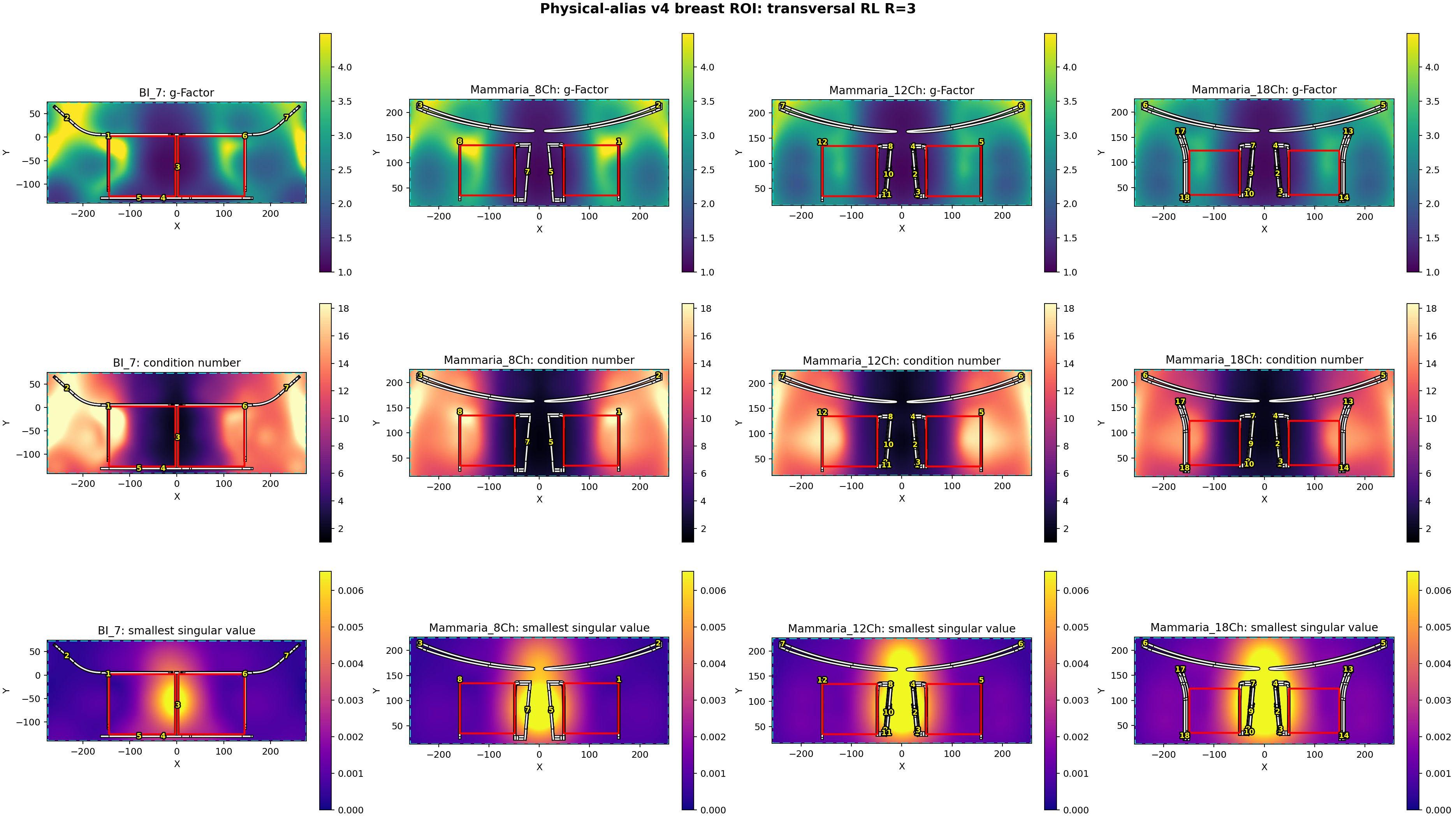transversal RL R=3