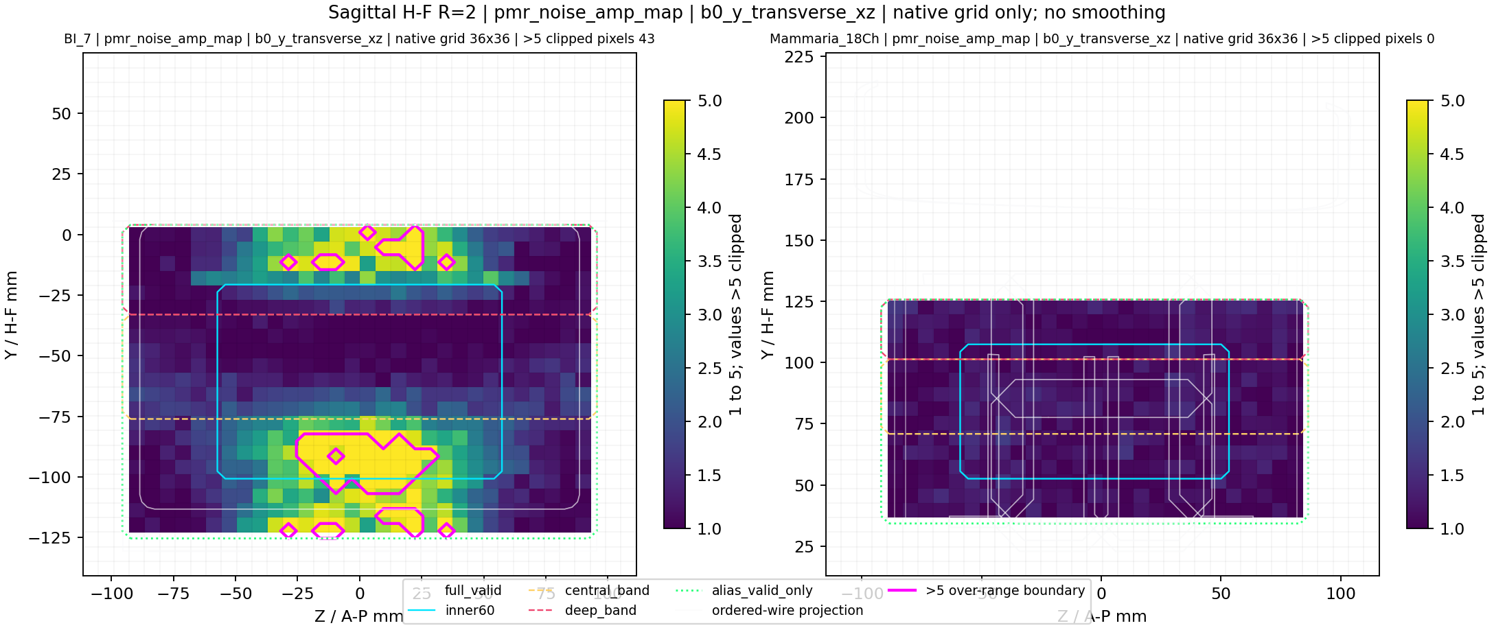 Sagittal H-F R=2 pmr_noise_amp_map