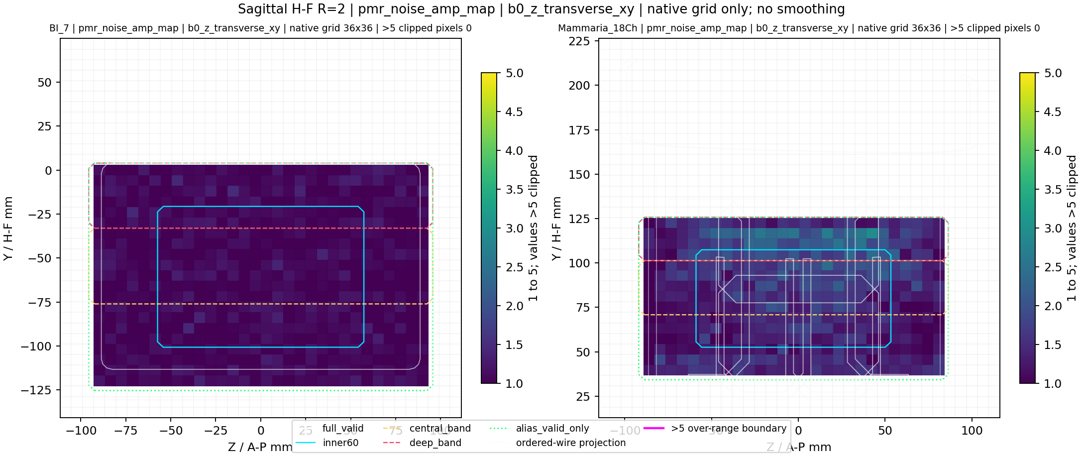 Sagittal H-F R=2 pmr_noise_amp_map