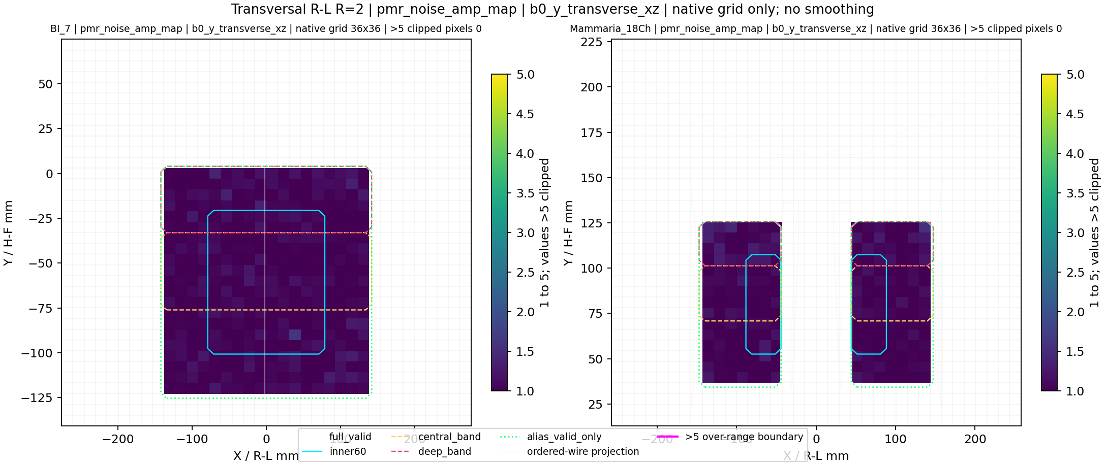 Transversal R-L R=2 pmr_noise_amp_map