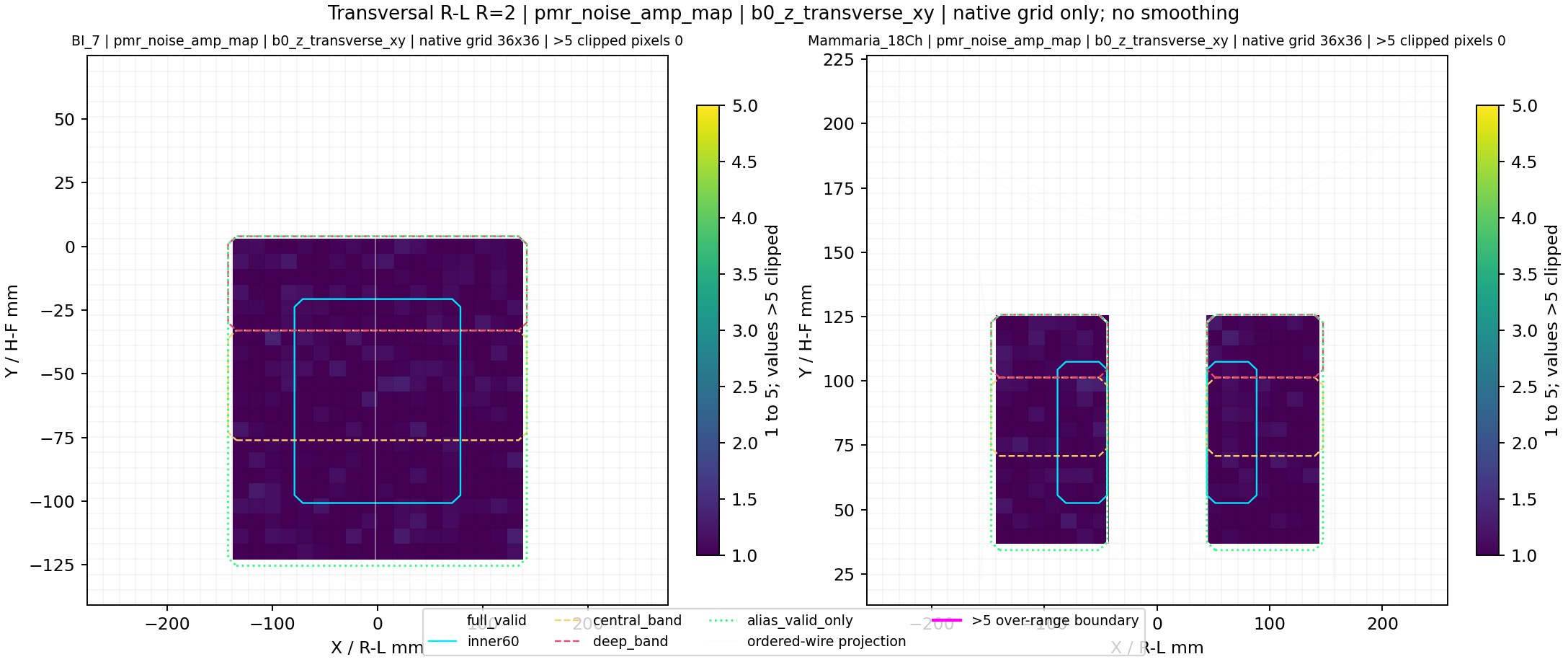 Transversal R-L R=2 pmr_noise_amp_map