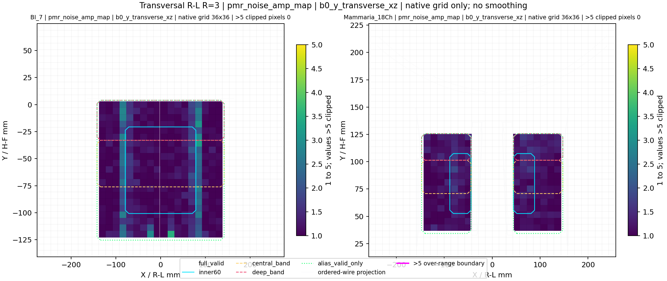 Transversal R-L R=3 pmr_noise_amp_map