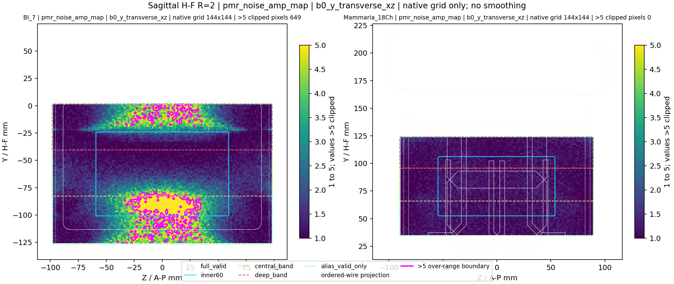 Sagittal H-F R=2 pmr_noise_amp_map
