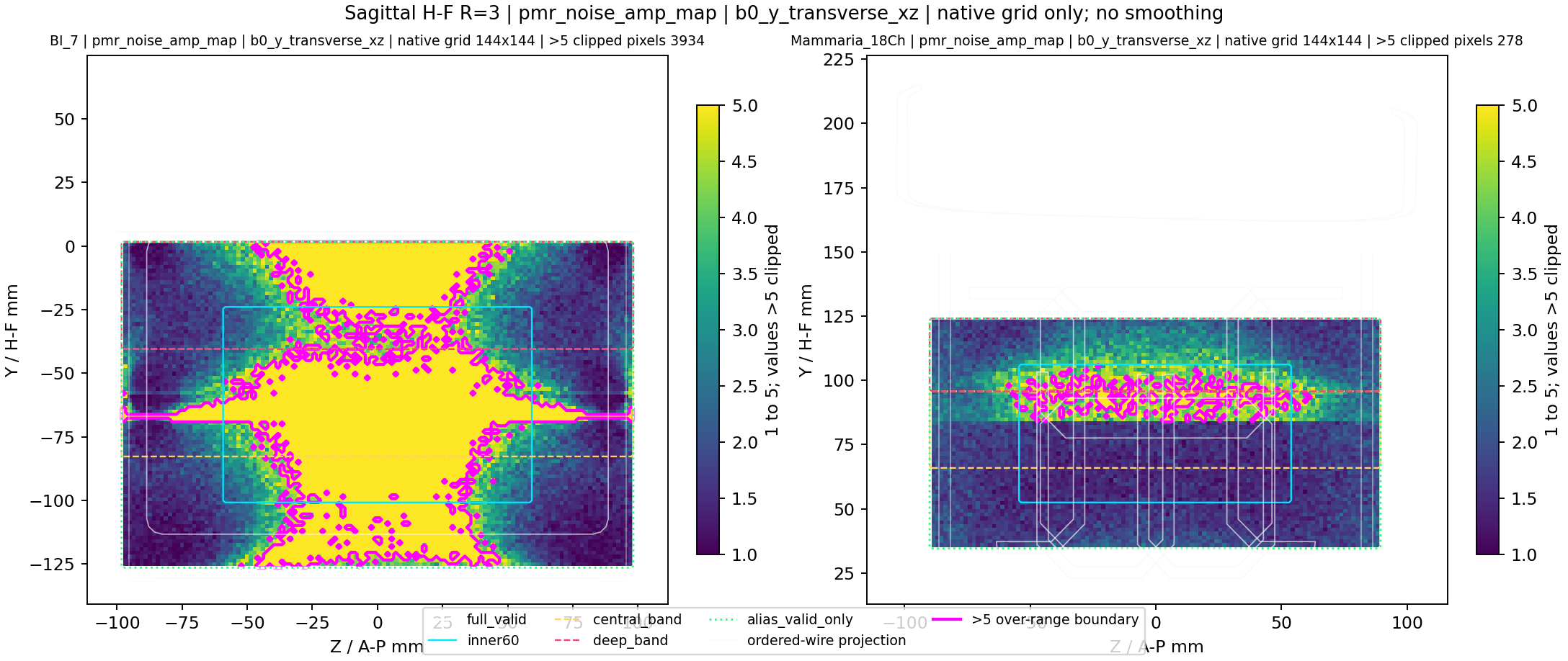 Sagittal H-F R=3 pmr_noise_amp_map