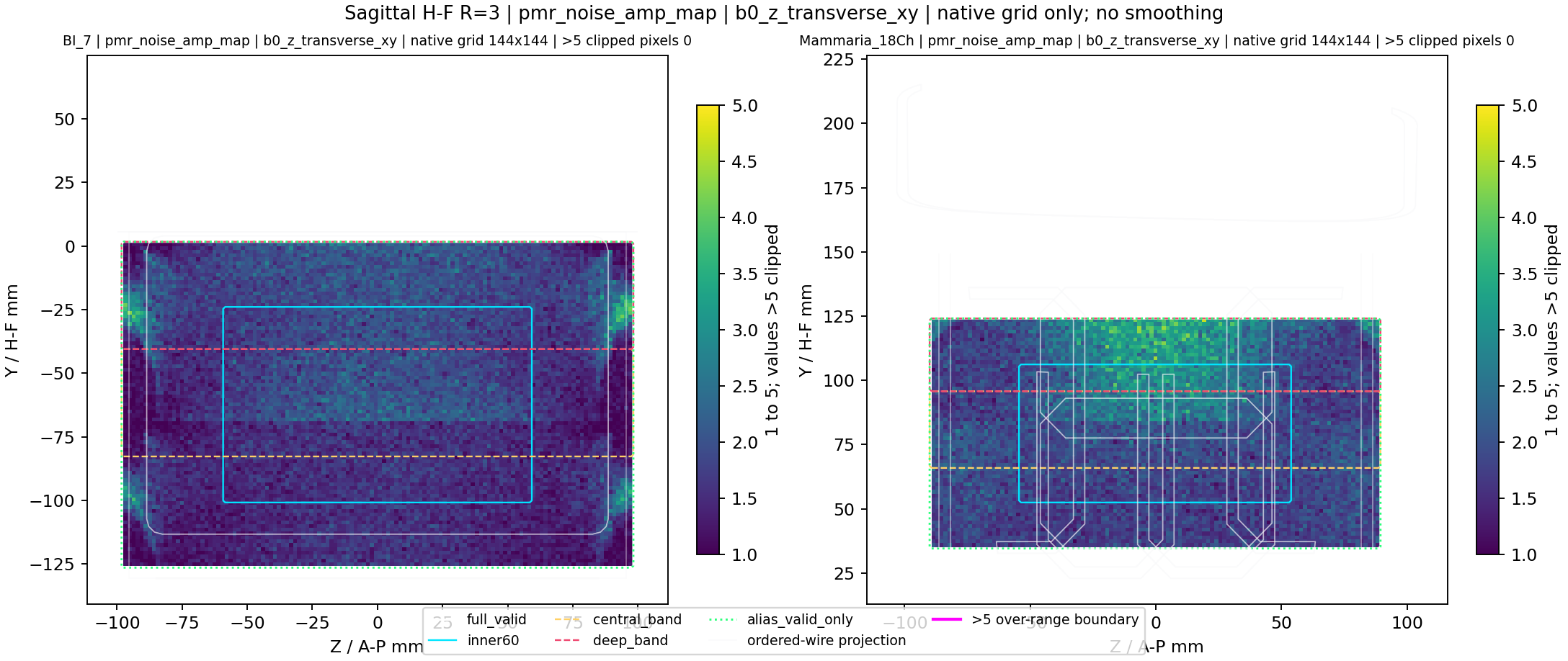 Sagittal H-F R=3 pmr_noise_amp_map