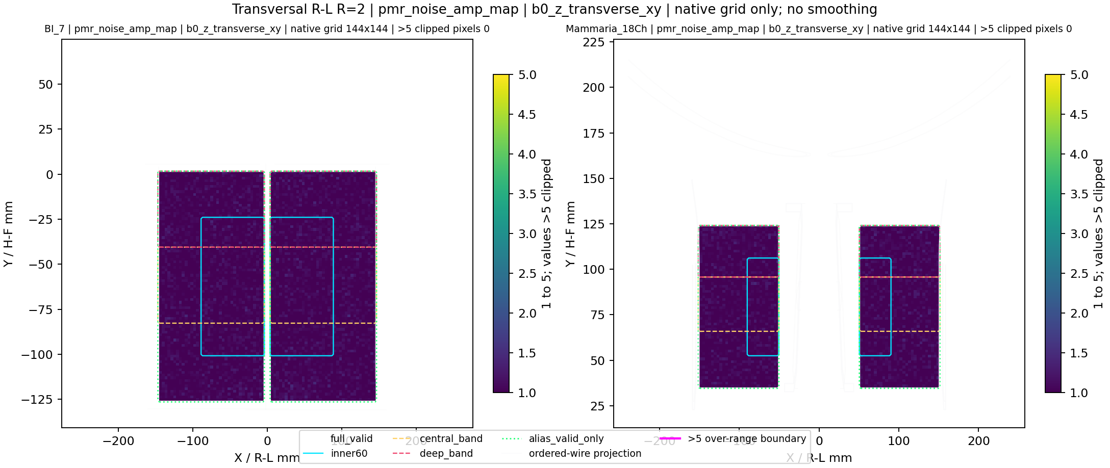 Transversal R-L R=2 pmr_noise_amp_map