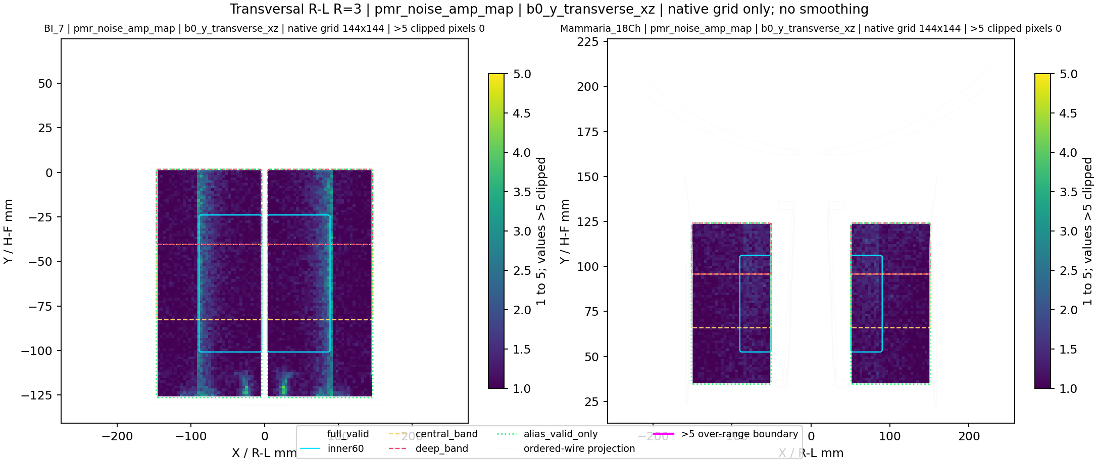 Transversal R-L R=3 pmr_noise_amp_map