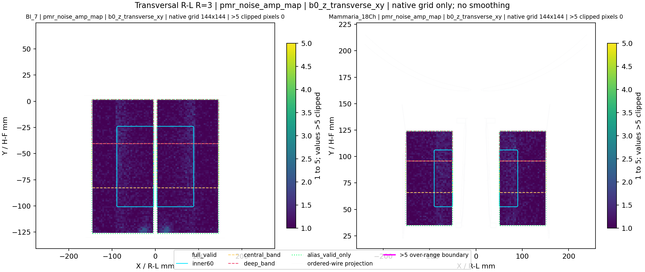 Transversal R-L R=3 pmr_noise_amp_map