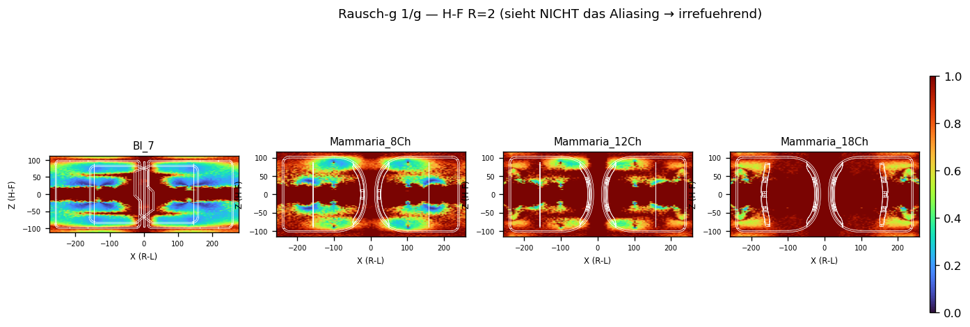 GRAPPA Rausch-g H-F R=2