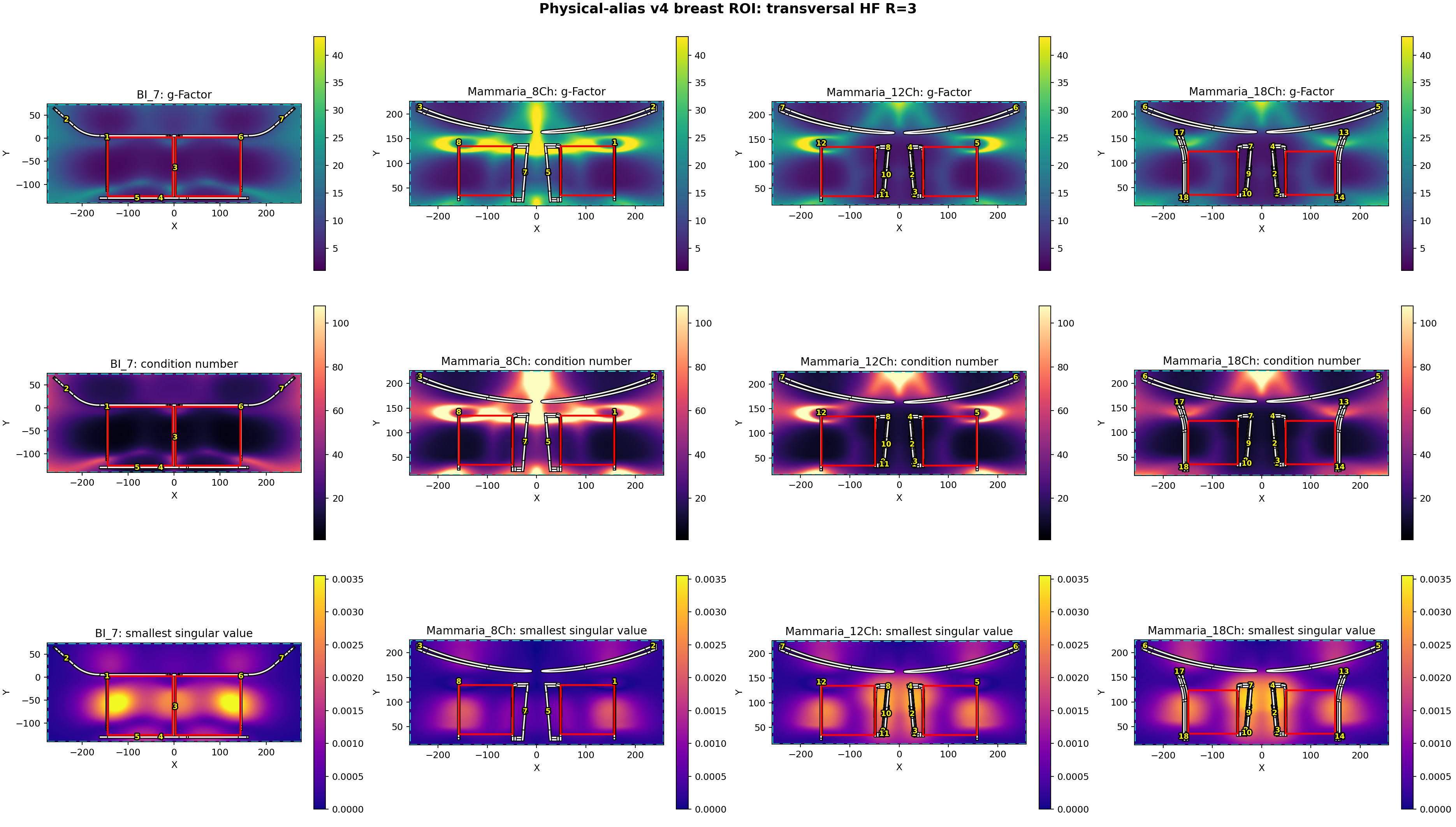 transversal HF R=3
