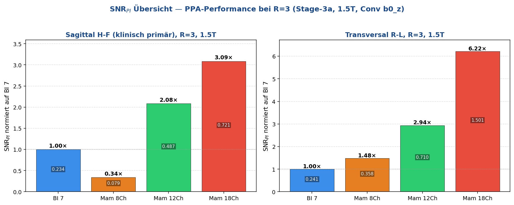 SNR_PI R=3 1.5T