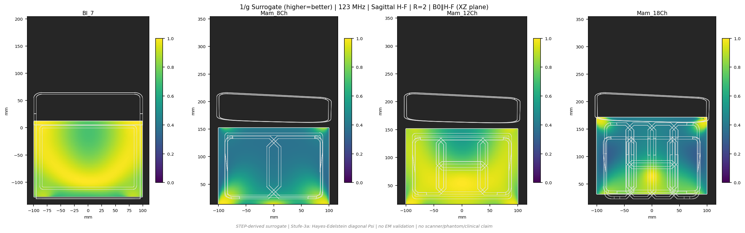 1/g R=2 &mdash; Sag H-F &mdash; 3T (b0_y)