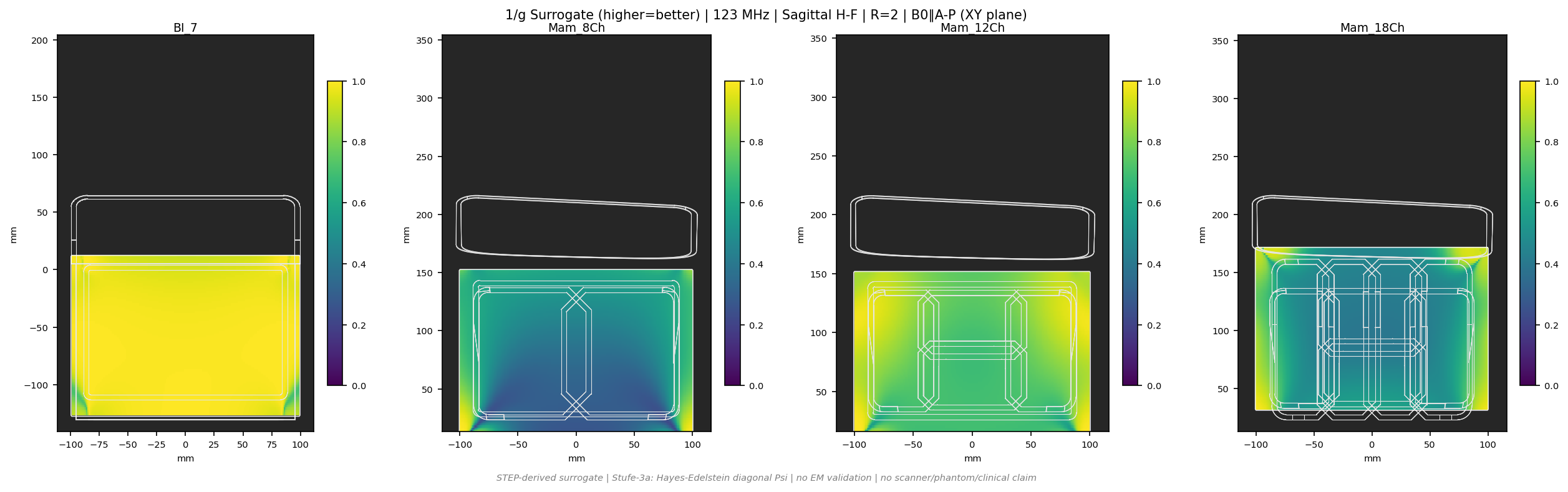 1/g R=2 &mdash; Sag H-F &mdash; 3T