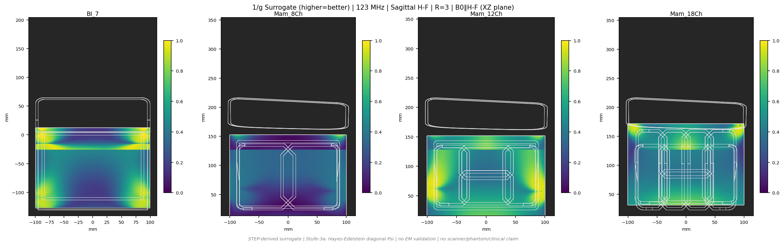 1/g R=3 &mdash; Sag H-F &mdash; 3T (b0_y)