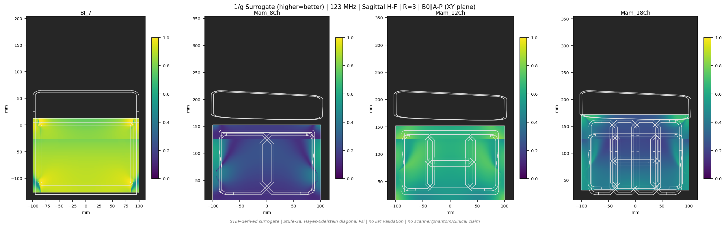 1/g R=3 &mdash; Sag H-F &mdash; 3T