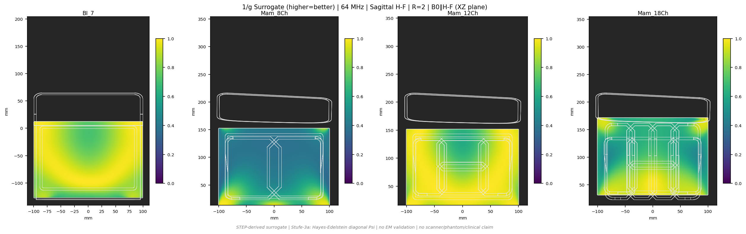 1/g R=2 &mdash; Sag H-F &mdash; 1.5T (b0_y)