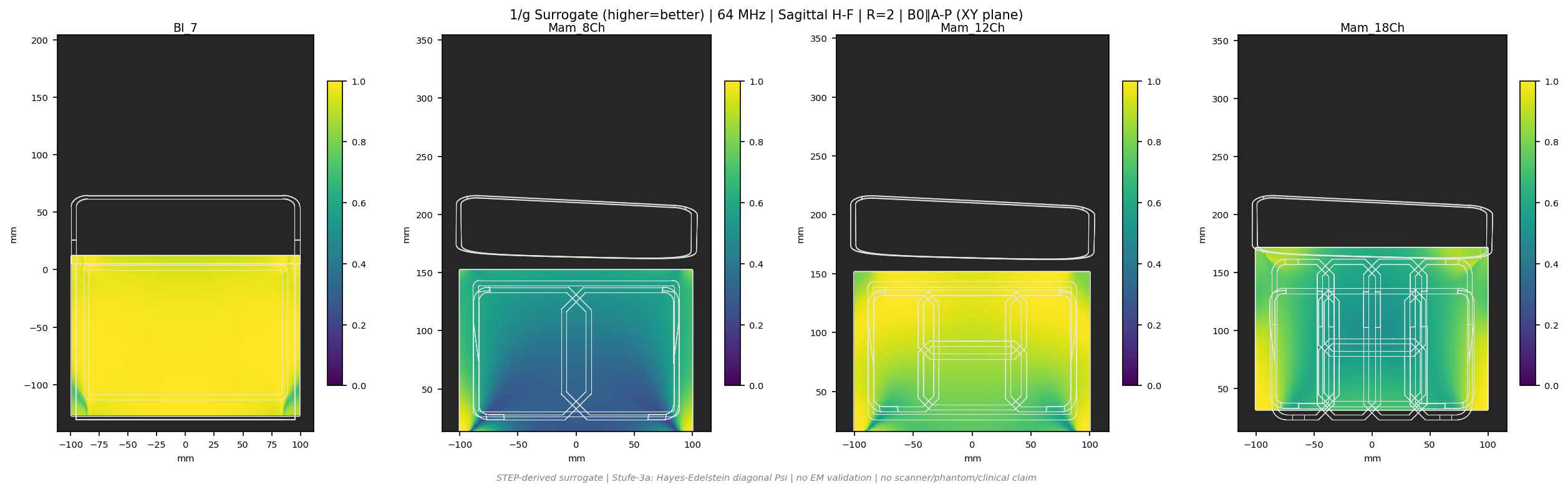 1/g R=2 &mdash; Sag H-F &mdash; 1.5T