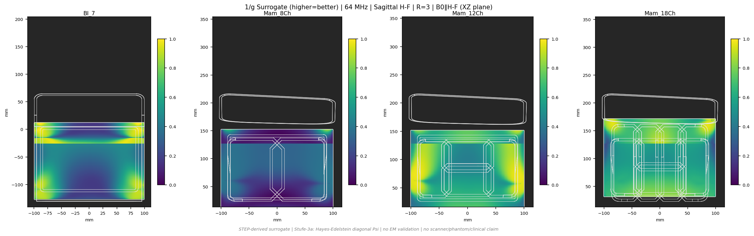 1/g R=3 &mdash; Sag H-F &mdash; 1.5T (b0_y)