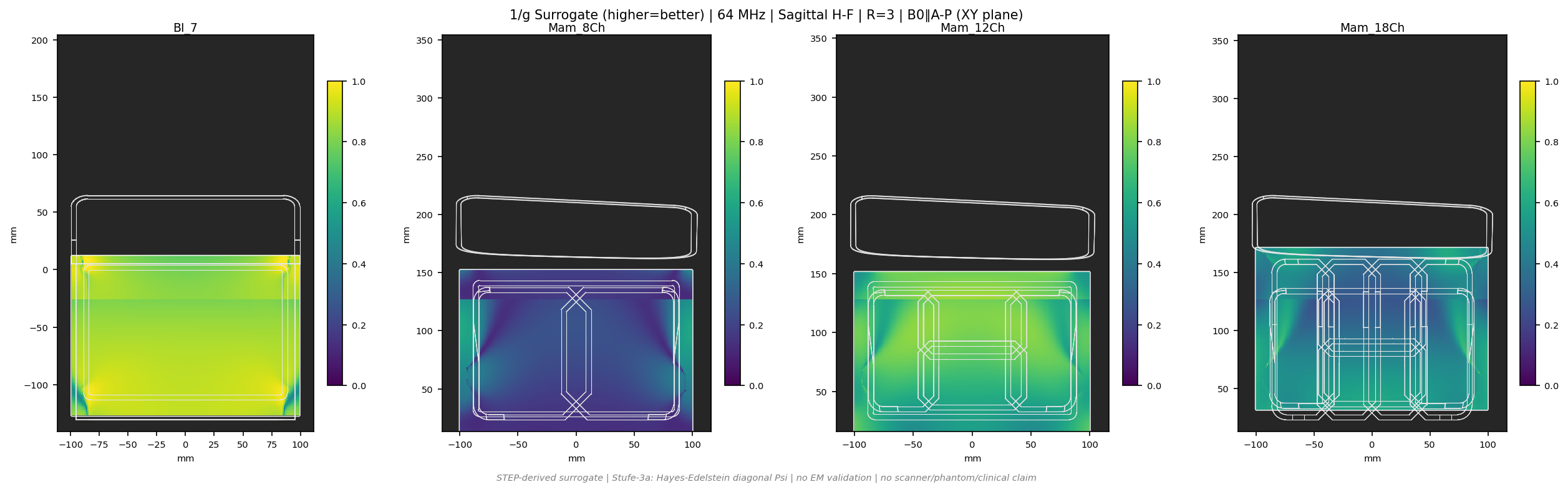 1/g R=3 &mdash; Sag H-F &mdash; 1.5T