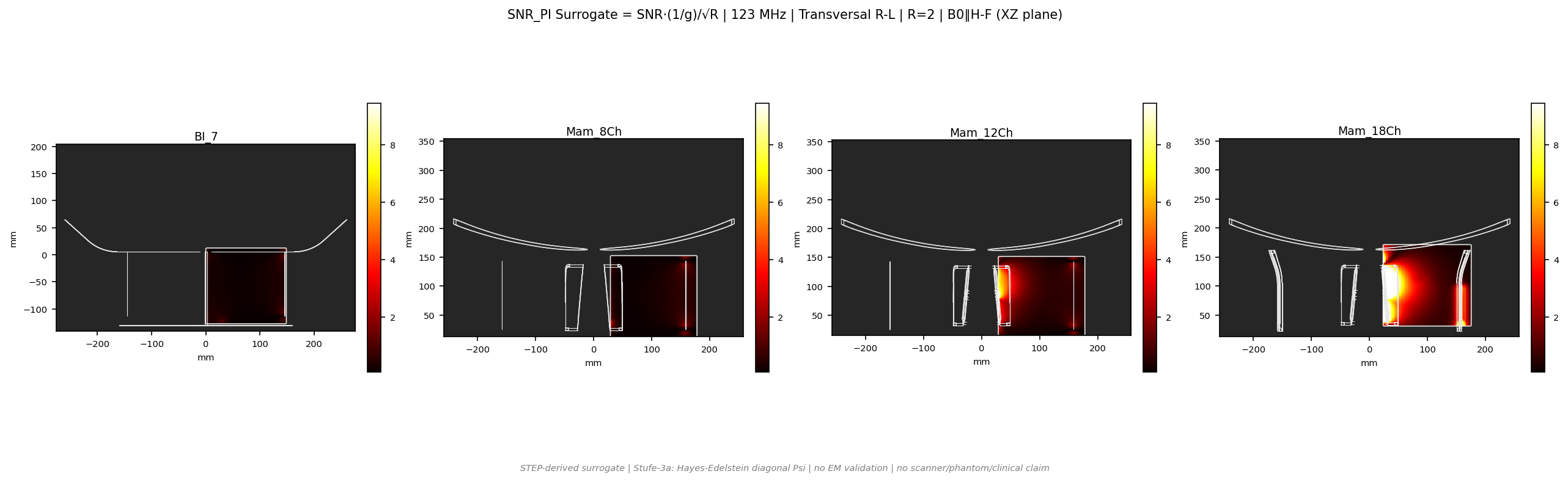 SNR<sub>PI</sub> R=2 &mdash; Trans R-L &mdash; 3T (b0_y)
