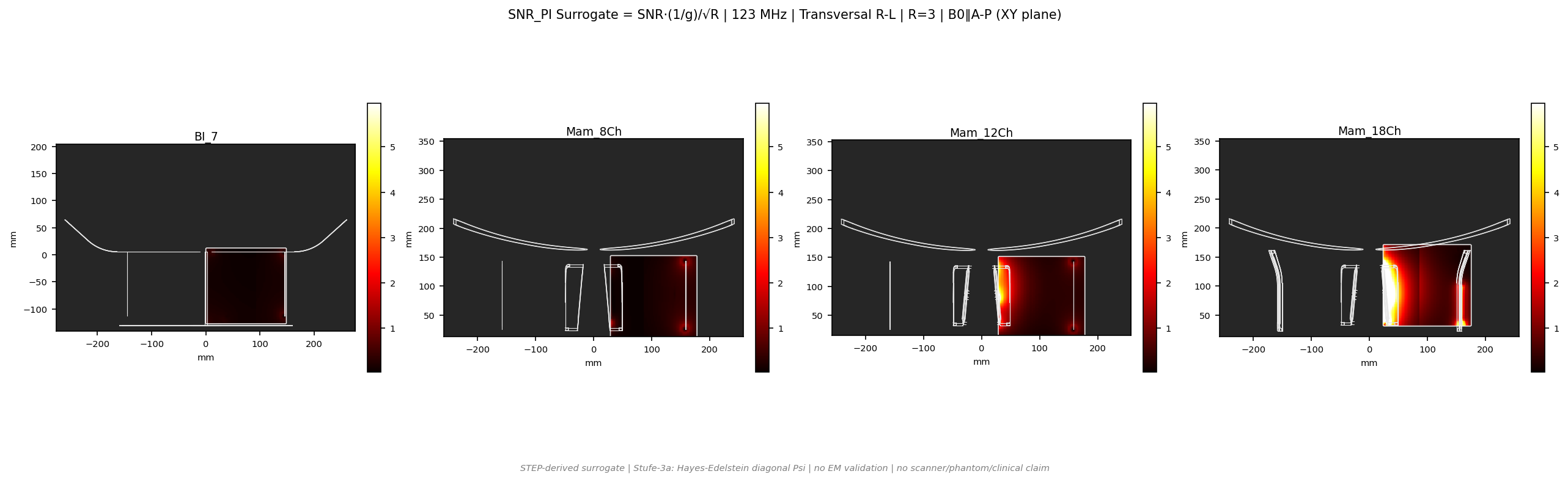 SNR<sub>PI</sub> R=3 &mdash; Trans R-L &mdash; 3T