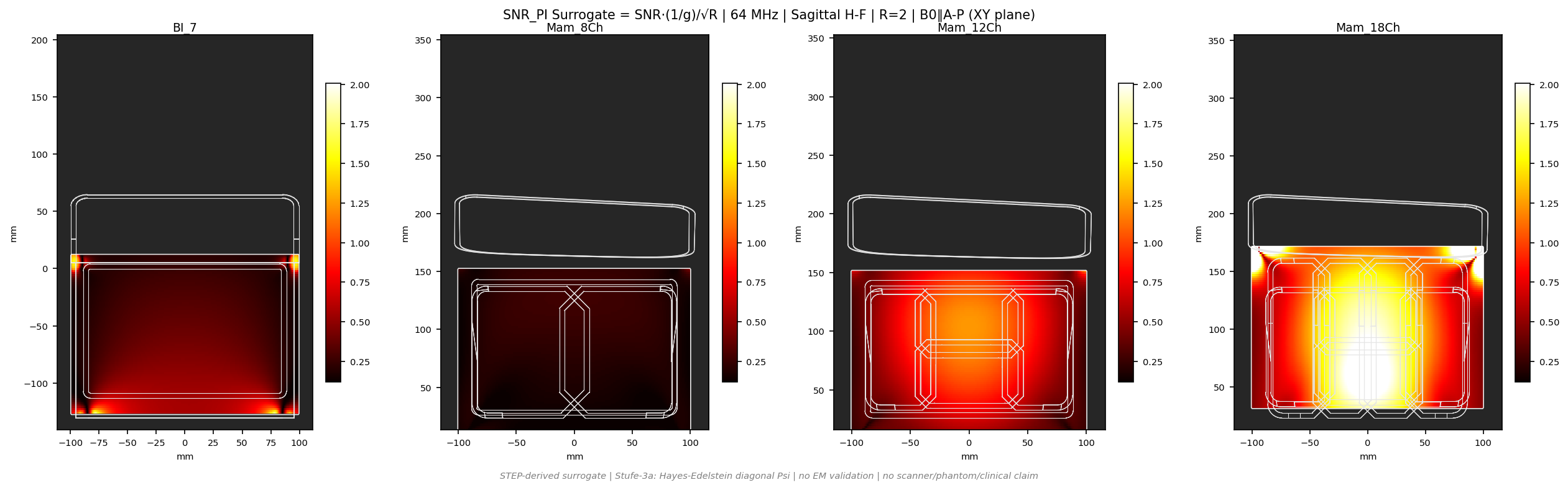 SNR<sub>PI</sub> R=2 &mdash; Sag H-F &mdash; 1.5T