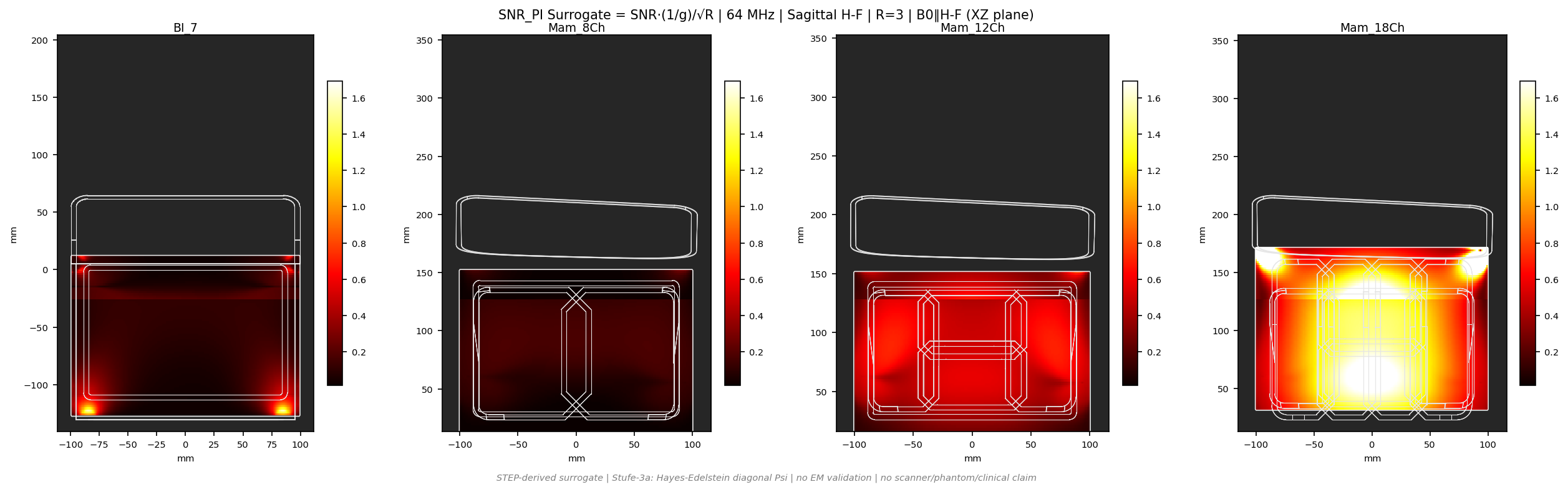 SNR<sub>PI</sub> R=3 &mdash; Sag H-F &mdash; 1.5T (b0_y)