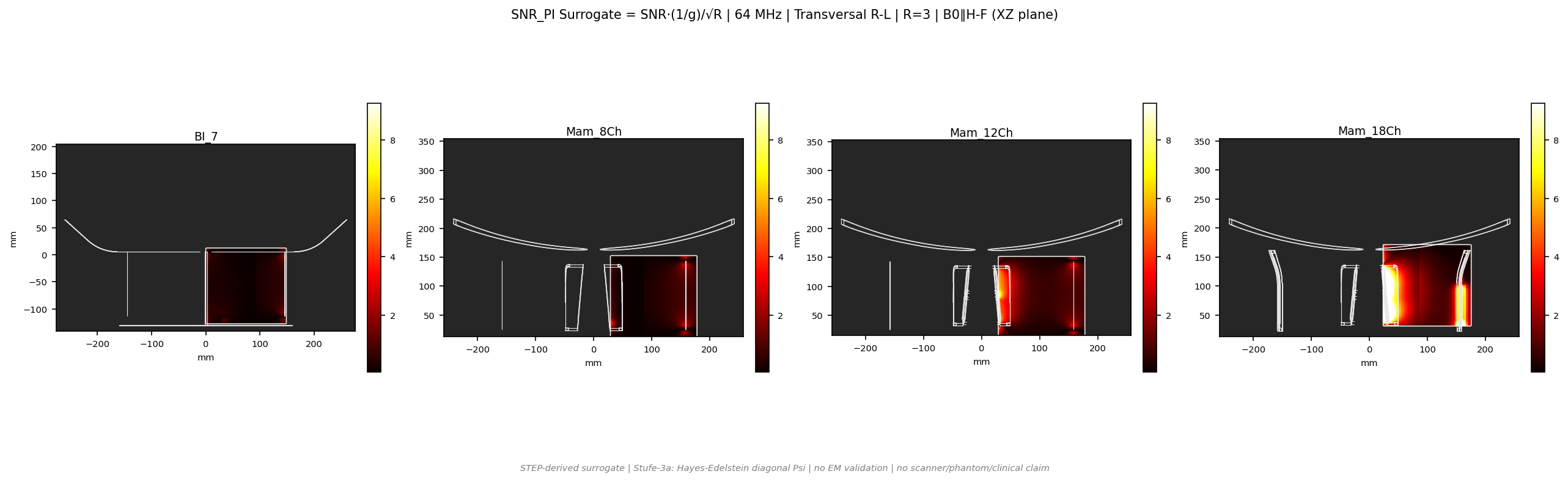 SNR<sub>PI</sub> R=3 &mdash; Trans R-L &mdash; 1.5T (b0_y)